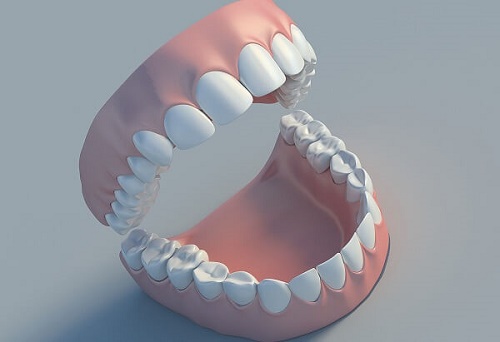 Trồng răng có ảnh hưởng gì không? Thông tin cần biết 2 Trồng răng có ảnh hưởng gì không? Thông tin cần biết 2