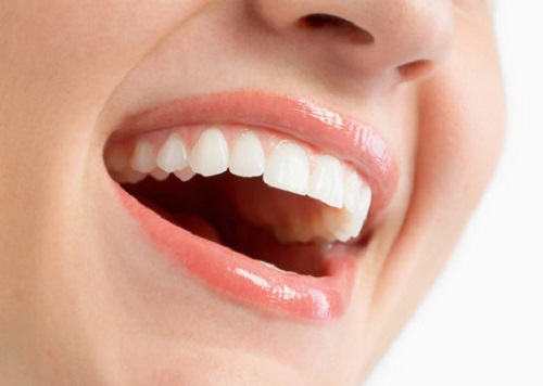 Trồng răng giả có niềng được không? Chuyên gia tư vấn 2 Trồng răng giả có niềng được không? Chuyên gia tư vấn 2