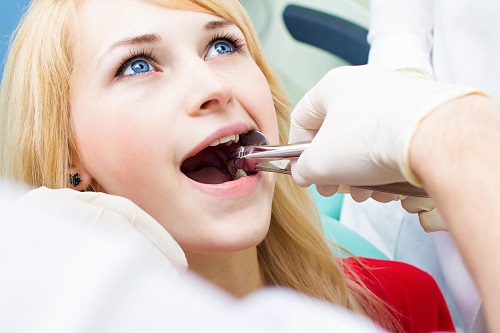 Trồng răng sứ bị đen chân răng - Nguyên nhân do đâu 2 Trồng răng sứ bị đen chân răng - Nguyên nhân do đâu 2