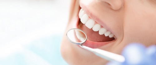 Tham khảo nội dung: Trồng răng sứ có tháo ra được không? 4 Tham khảo nội dung: Trồng răng sứ có tháo ra được không? 4