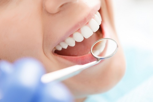 Trồng răng cửa mất bao lâu? Có phụ thuộc kỹ thuật trồng không? 2 Trồng răng cửa mất bao lâu? Có phụ thuộc kỹ thuật trồng không? 2