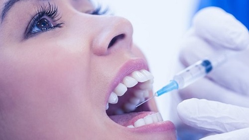 Trồng răng sứ có đau không? Chuyên gia giải đáp 3 Trồng răng sứ có đau không? Chuyên gia giải đáp 3