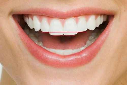 2 cách làm răng thỏ đẹp tự nhiên cho bạn làm răng thỏ 2 2 cách làm răng thỏ đẹp tự nhiên cho bạn làm răng thỏ 2