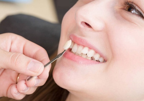 Trồng răng khểnh có đau không? Nên áp dụng kỹ thuật trồng nào? 2