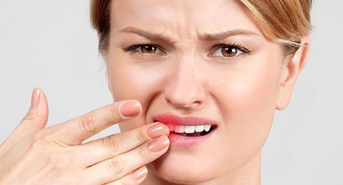 Răng sứ bị mòn - Nguyên nhân do đâu gây ra? 2
