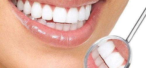 Răng sứ bị mòn - Nguyên nhân do đâu gây ra? 3