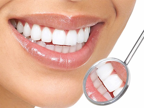 Răng sứ bị nhức nên làm gì khắc phục? 1