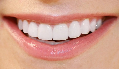 Bảng giá răng sứ tại Cần Thơ mới nhất 3