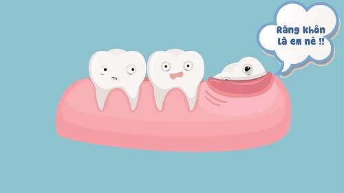 Răng khôn có phải răng số 8 không? Thông tin từ nha khoa 3